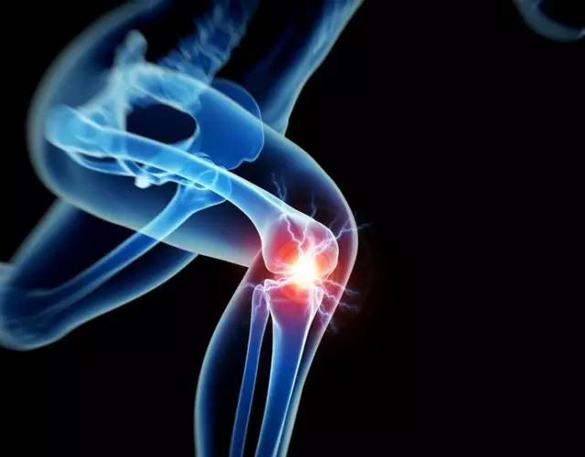 【健康科普系列十四】膝关节疼痛常见原因