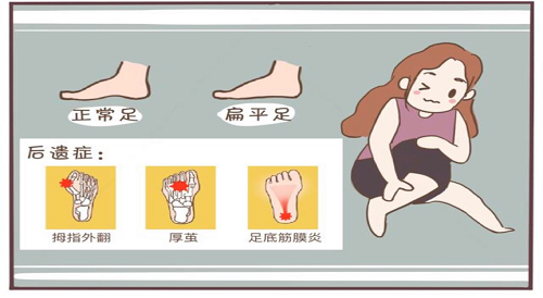 儿童康复科 | 关注扁平足，要从娃娃抓起